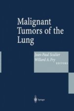 Malignant Tumors of the Lung