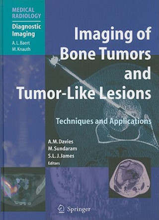 Imaging of Bone Tumors and Tumor-Like Lesions