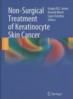 Non-Surgical Treatment of Keratinocyte Skin Cancer