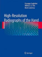 High-Resolution Radiographs of the Hand