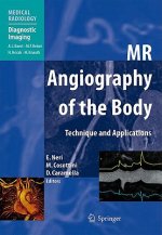 MR Angiography of the Body