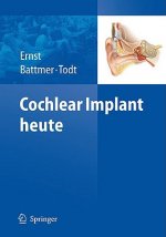 Cochlear Implant Heute