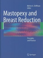 Mastopexy and Breast Reduction