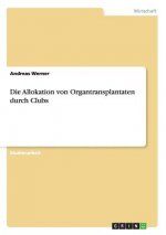 Die Allokation von Organtransplantaten durch Clubs