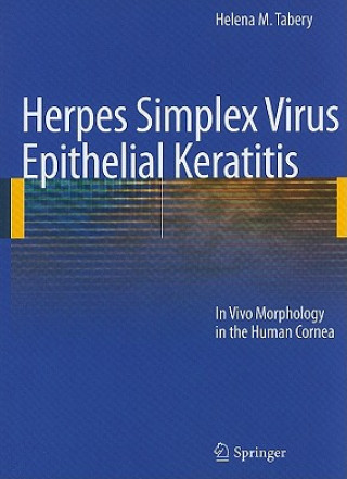 Herpes Simplex Virus Epithelial Keratitis