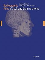 Radiographic Atlas of Skull and Brain Anatomy