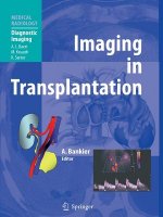 Imaging in Transplantation