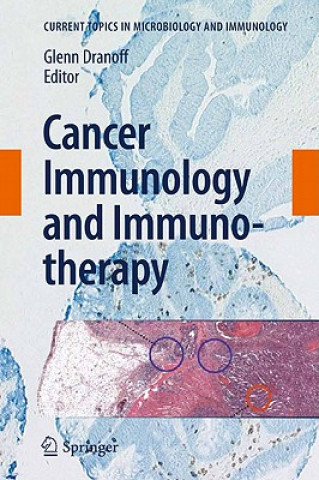 Cancer Immunology and Immunotherapy