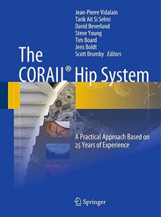 CORAIL (R) Hip System