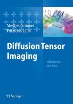 Diffusion Tensor Imaging