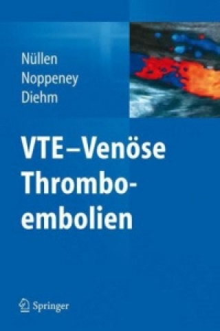 VTE - Venose Thromboembolien