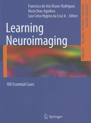 Learning Neuroimaging