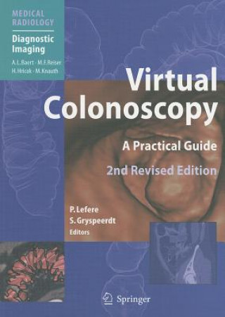 Virtual Colonoscopy
