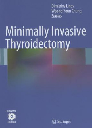Minimally Invasive Thyroidectomy