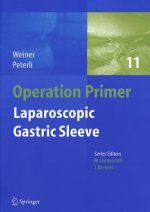 Laparoscopic Gastric Sleeve