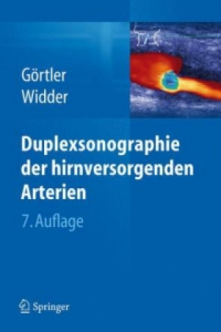 Duplexsonographie der hirnversorgenden Arterien, m. 1 Buch, m. 1 E-Book