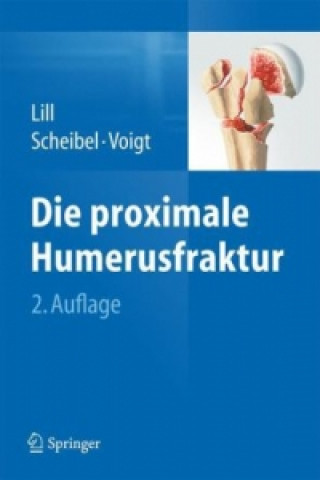 Die proximale Humerusfraktur