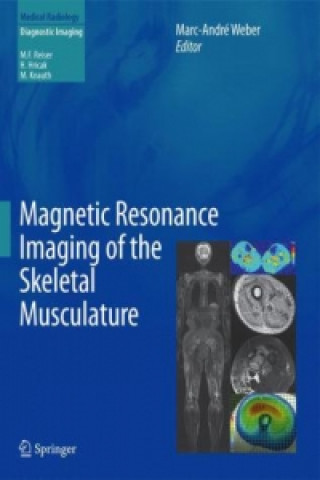 Magnetic Resonance Imaging of the Skeletal Musculature (Marc-André Weber)(Kemény kötésű)