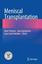 Meniscal Transplantation
