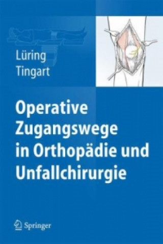 Operative Zugangswege in Orthopadie und Unfallchirurgie