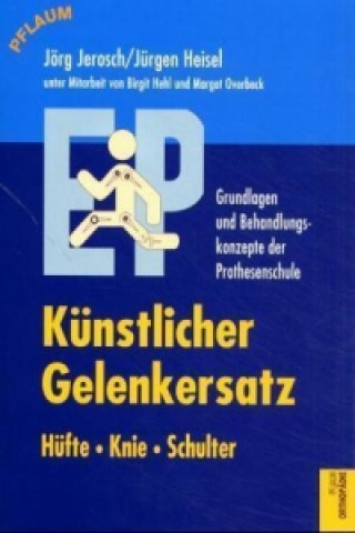 Künstlicher Gelenkersatz