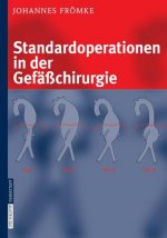 Standardoperationen in der Gefasschirurgie