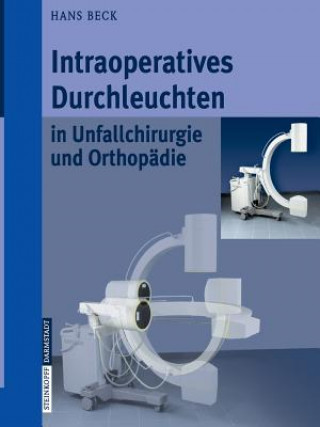 Intraoperatives Durchleuchten in Unfallchirurgie und Orthopadie