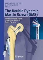 Double Dynamic Martin Screw (DMS)