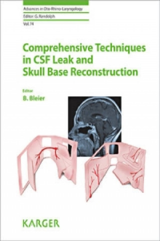 Comprehensive Techniques in CSF Leak Repair and Skull Base Reconstruction