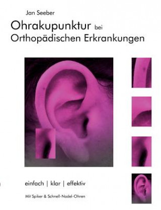 Ohrakupunktur bei Orthopadischen Erkrankungen