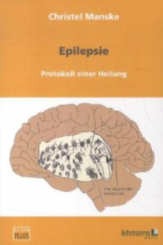 Epilepsie: Protokoll einer Heilung