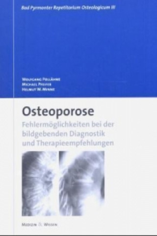 Osteoporose