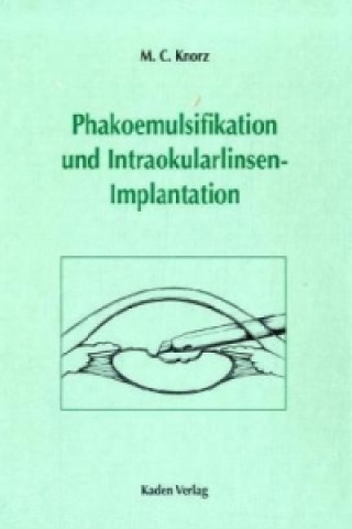 Phakoemulsifikation und Intraokularlinsenimplantation, m. CD-ROM