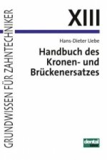 Handbuch des Kronen- und Brückenersatzes