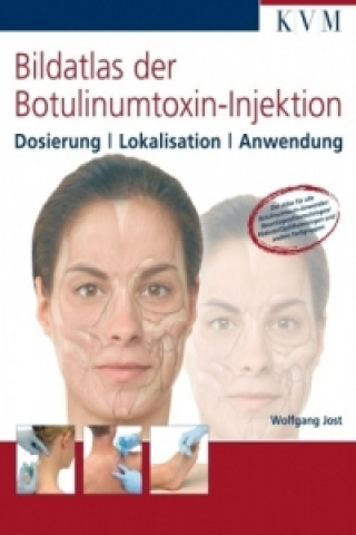 Bildatlas der Botulinumtoxin-Injektion