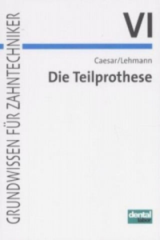 Die Teilprothese