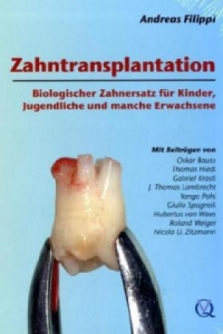 Zahntransplantation