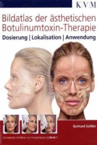 Bildatlas der ästhetischen Botulinumtoxin-Therapie
