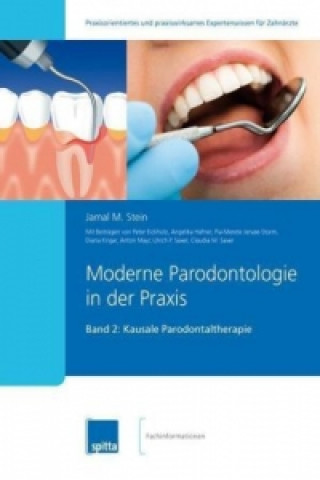 Moderne Parodontologie in der Praxis. Bd.2