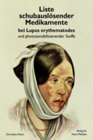 Liste schubauslösender Medikamente bei Lupus erythematodes und photosensibilisierender Stoffe
