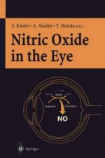 Nitric Oxide in the Eye