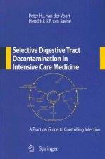 Selective Digestive Tract Decontamination in Intensive Care Medicine: a Practical Guide to Controlling Infection