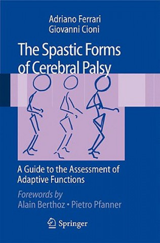 Spastic Forms of Cerebral Palsy