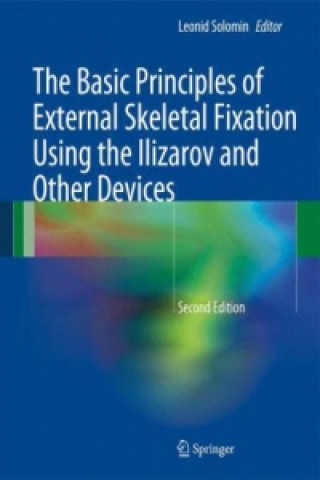 Basic Principles of External Skeletal Fixation Using the Ilizarov and Other Devices