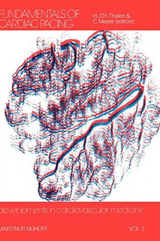 Fundamentals of Cardiac Pacing