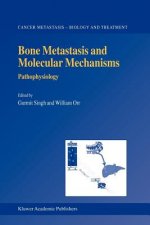 Bone Metastasis and Molecular Mechanisms