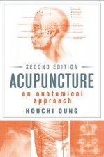 Acupuncture