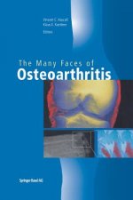 Many Faces of Osteoarthritis