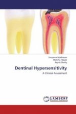 Dentinal Hypersensitivity