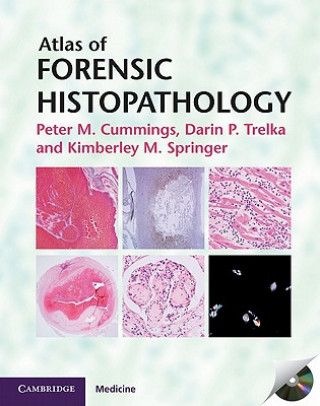 Atlas of Forensic Histopathology (Peter M. CummingsDarin P. TrelkaKimberley M. Springer)(Pevná)